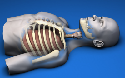 Pleural Space Decompression Model